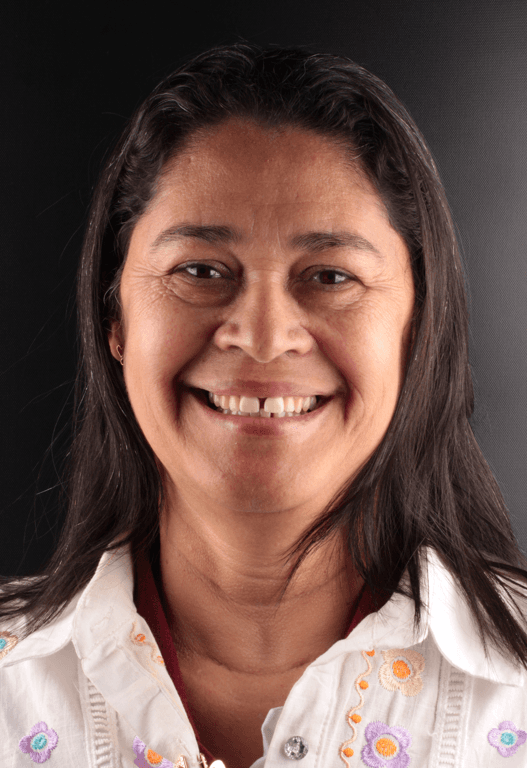 Antes – Paciente 3